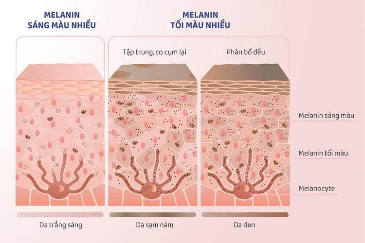 Sắc tố melanin
